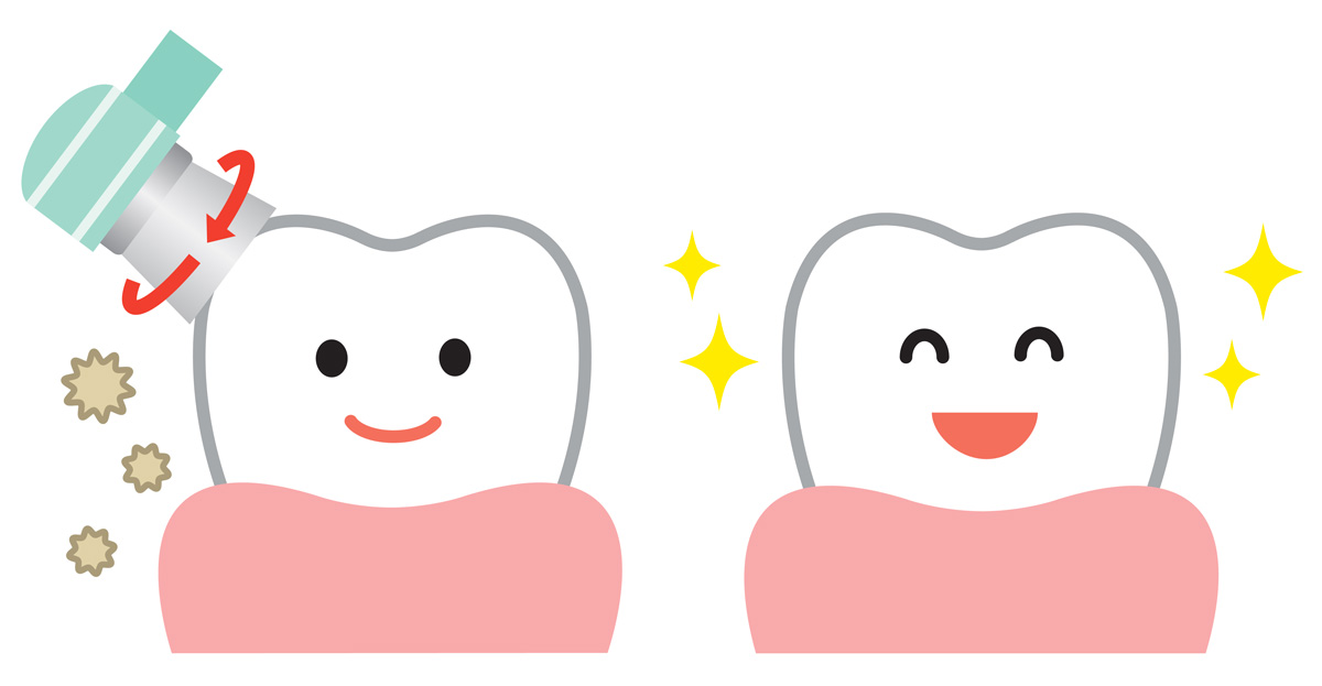 みまや歯科クリニック ＰＭＴＣってこんなにスゴイ！