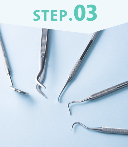 みまや歯科クリニック ステップ3