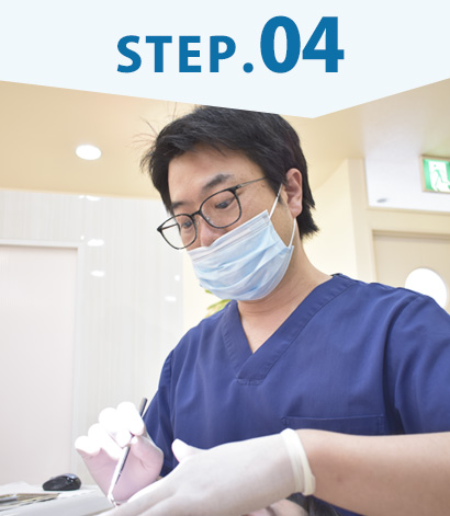 みまや歯科クリニック ステップ4
